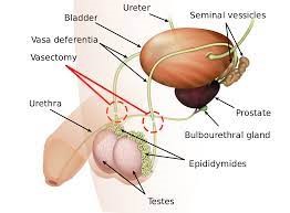 anatomy of a vasectomy