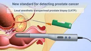 Prostate biopsy probe and needle